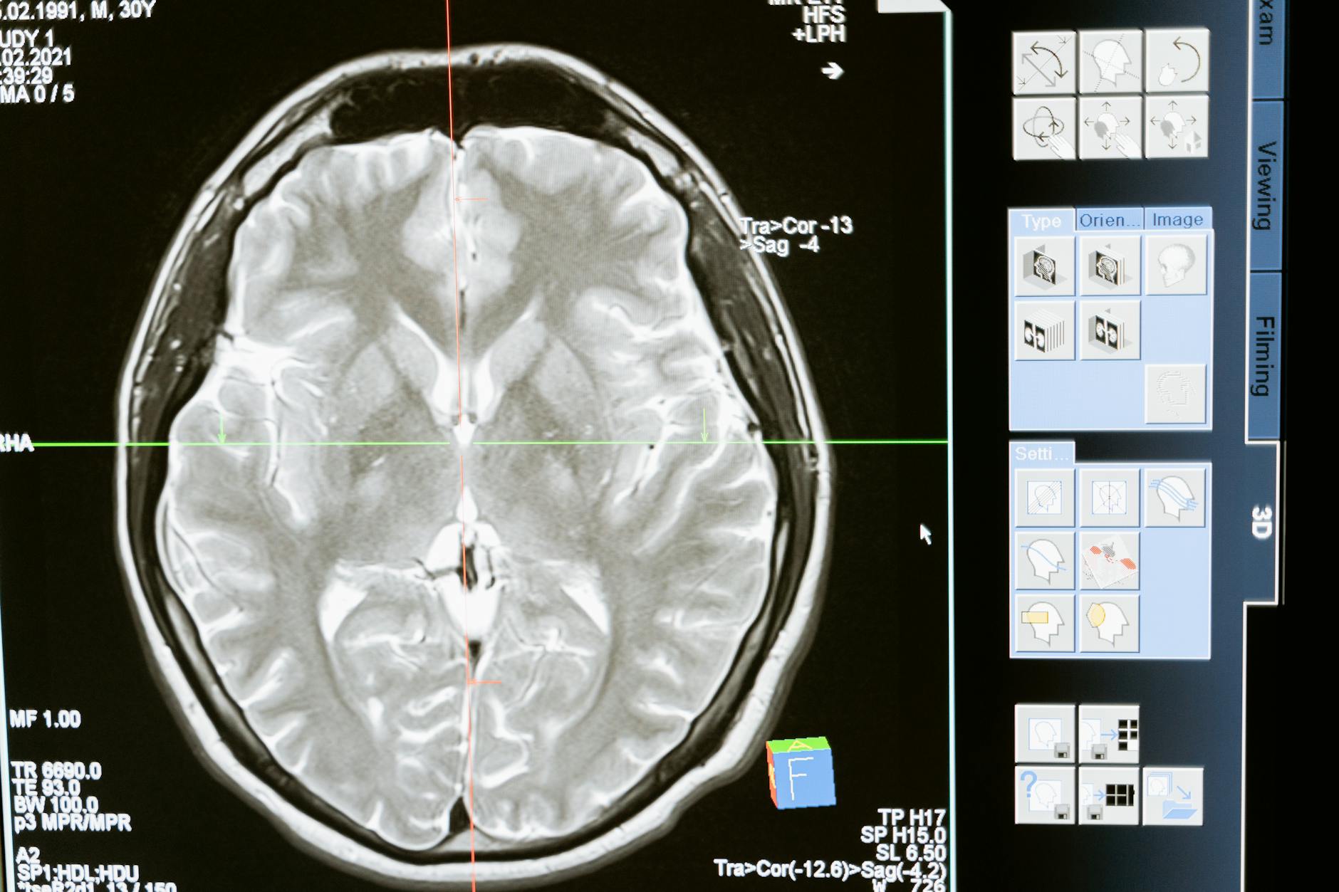 Boost Your Brain: The Science Behind Aerobic Exercise & Cognition