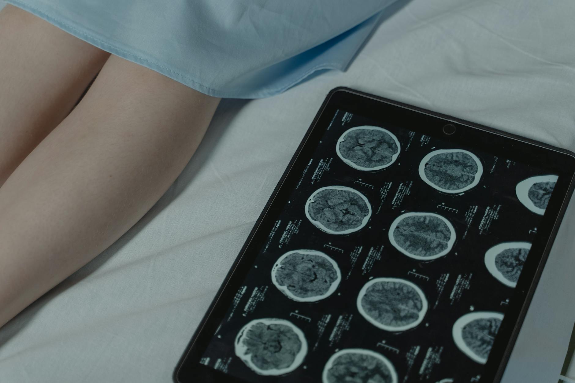 Home Brain Stimulation: A New Mental Wellness Tool?