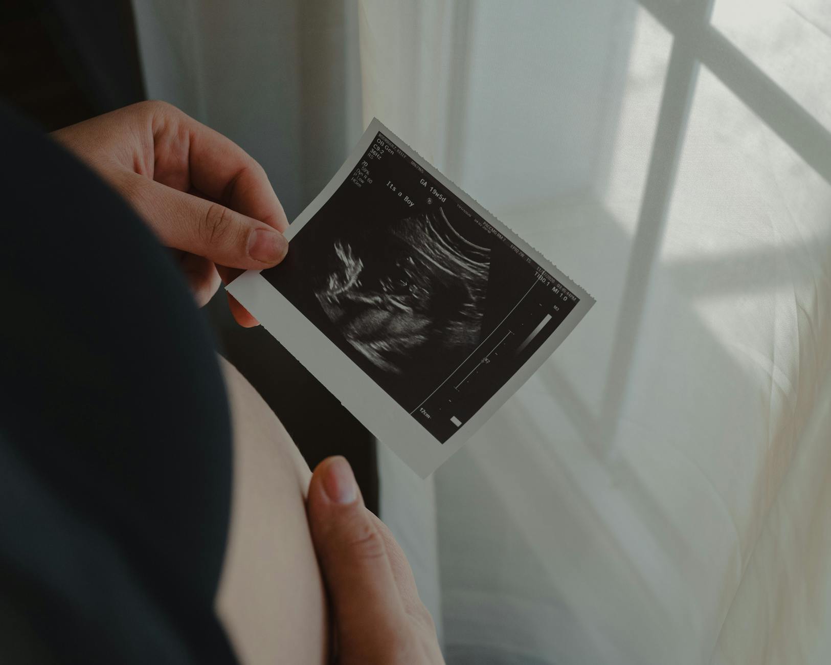 Lupus & Pregnancy: Navigating Your Unique Journey